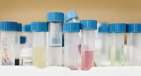 Prélèvement et analyse de l'eau d'une piscine avec un photomètre
